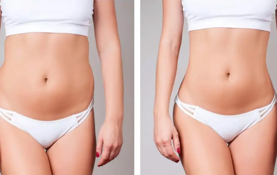 ceinture amincissante Bodysculptor avant après