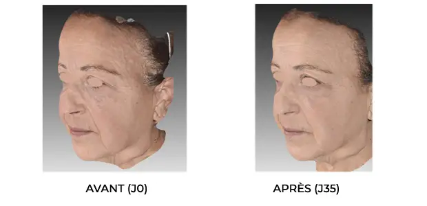 avant-apres3-1.jpg