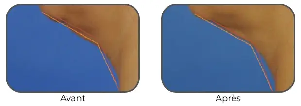 Masque Bodysculptor double menton avant après